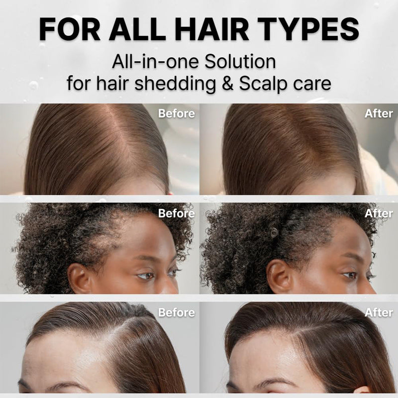 Scalp-Conditioning Root Ampoule